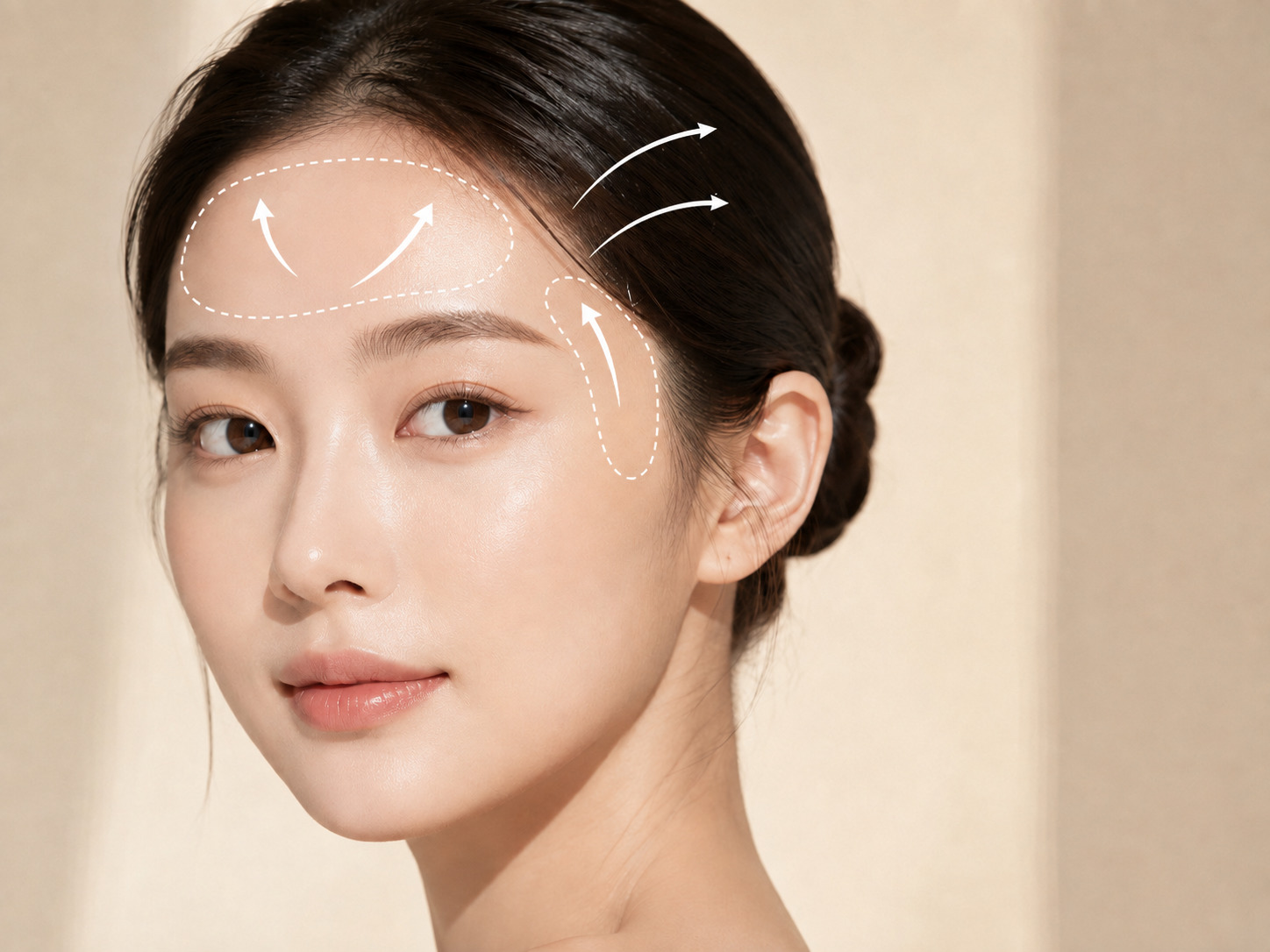 얼굴 전체의 자연스러운 볼륨과 탄력을 개선하는 스컬트라